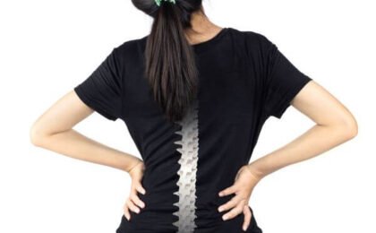 Bone Health in Women