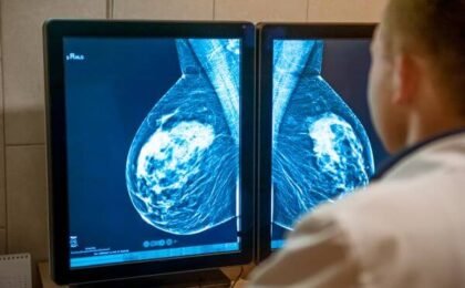 Why Routine Mammograms Matter