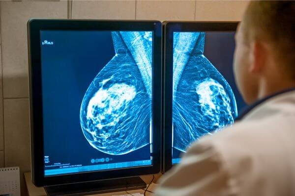 Why Routine Mammograms Matter: A Foundation for Yearly Women’s Wellness