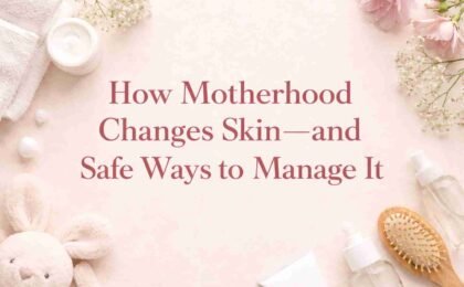 How Motherhood Changes Skin—and Safe Ways to Manage It