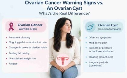 Ovarian Cancer Warning Signs vs. an Ovarian Cyst: What's the Real Difference?